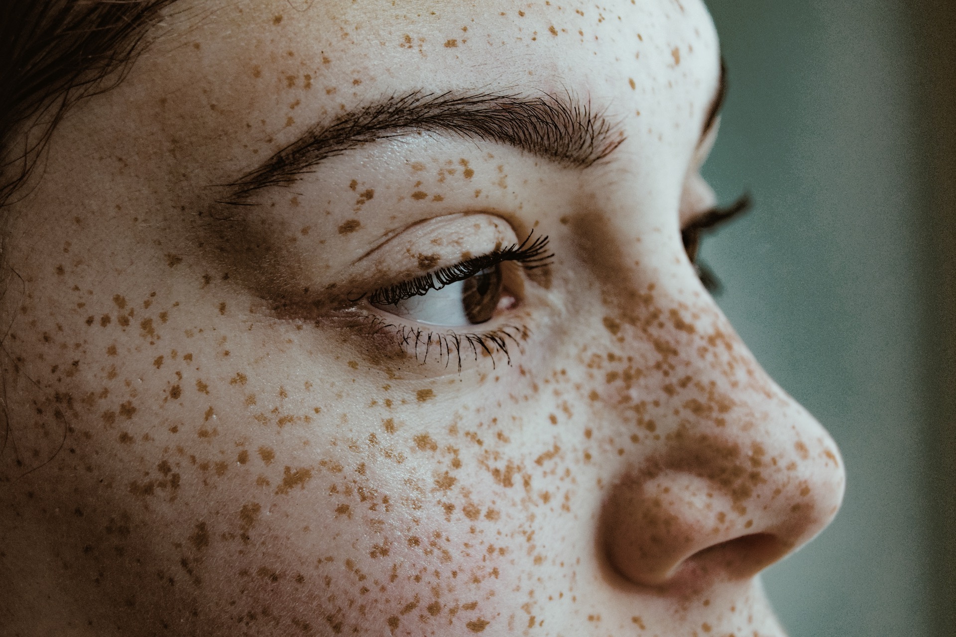Cosmetic Laser